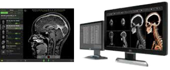 Acceso móvil a través de Visage Ease basado en Visage 7 (izquierda) y Visage 7 Enterprise Imaging Platform (derecha). Imagen por cortesía de Visage Imaging. Acceso móvil a través de Visage Ease basado en Visage 7 (izquierda) y Visage 7 Enterprise Imaging Platform (derecha). Imagen por cortesía de Visage Imaging.