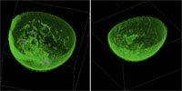 Renderizado volumétrico del sistema Whole Breast Ultrasound de TechniScan