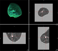 Imágenes volumétricas en plano axial, coronal y sagital obtenidas con el sistema WBU de TechniScan .