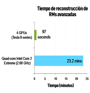 MRI Chart